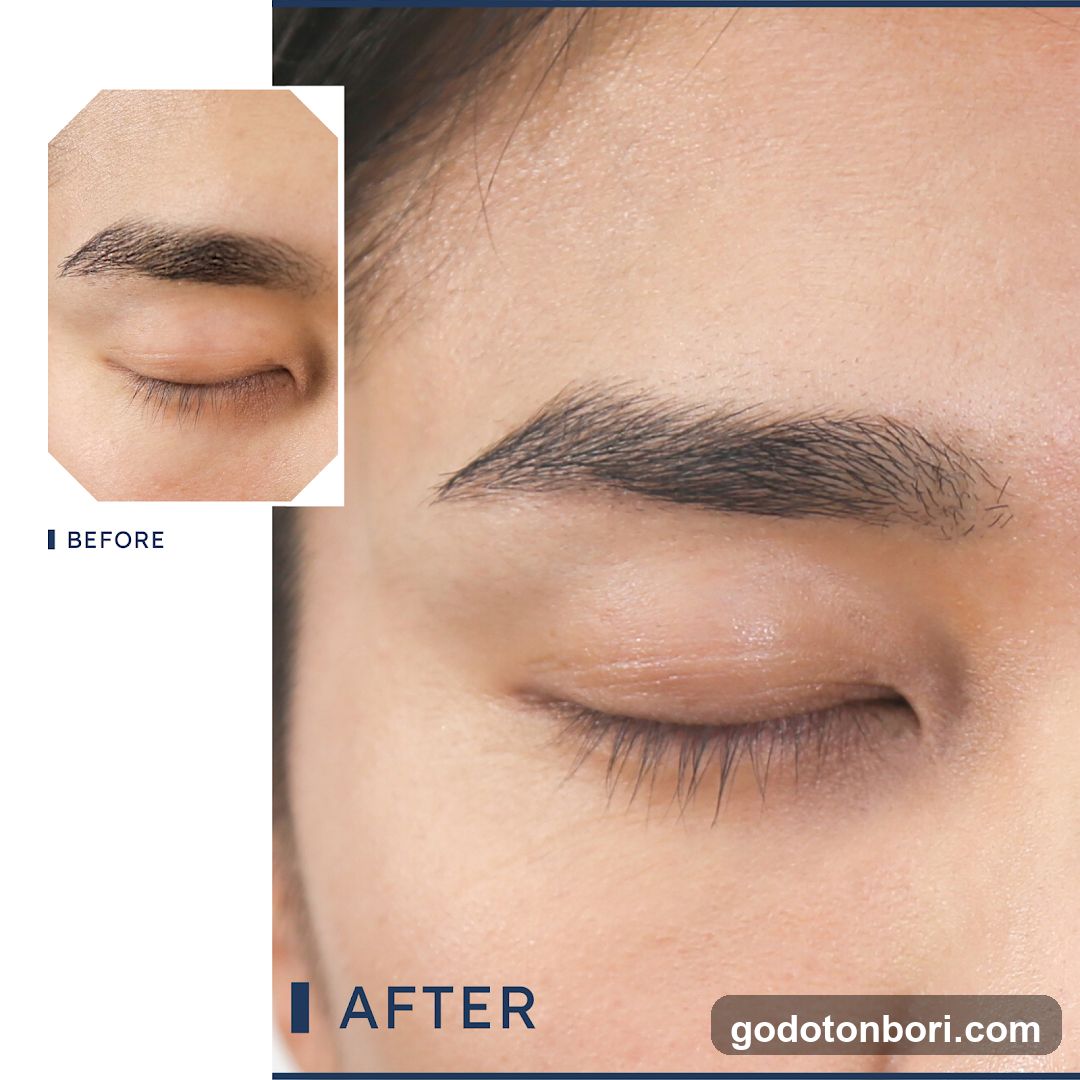 Eyebrow Enhancement Before and After