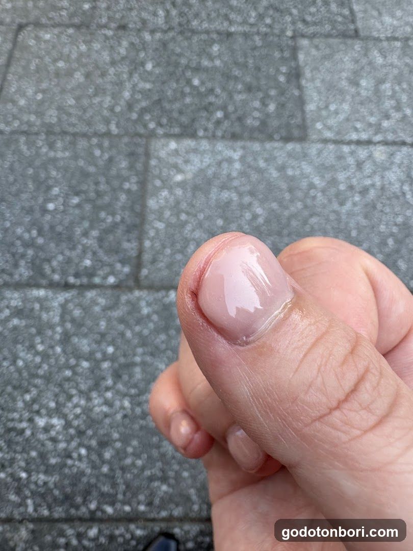 Fastnail